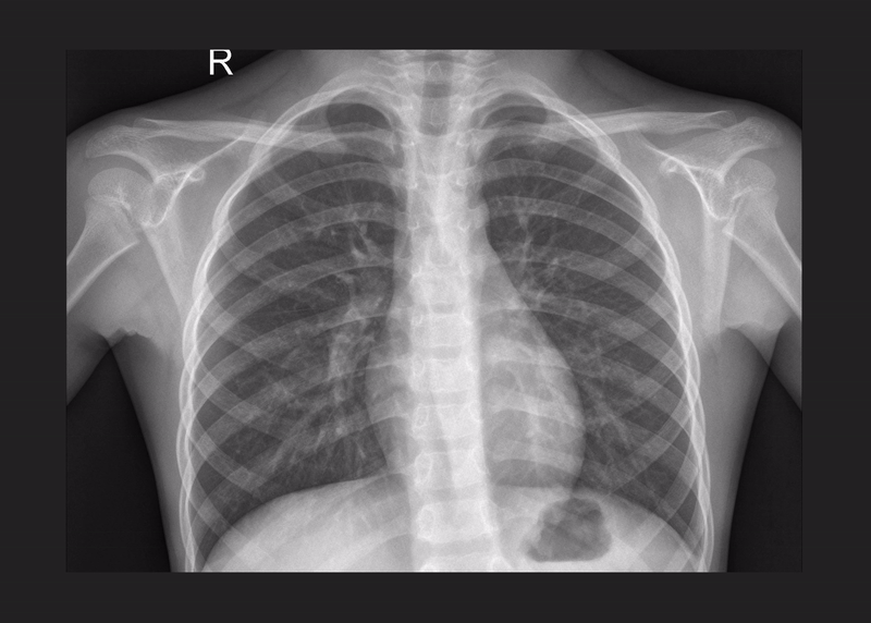 Xray images on loop